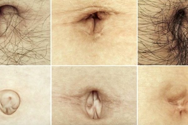 Форма твоего пупка может предупреждать о скрытых недугах! Вот это открытие…