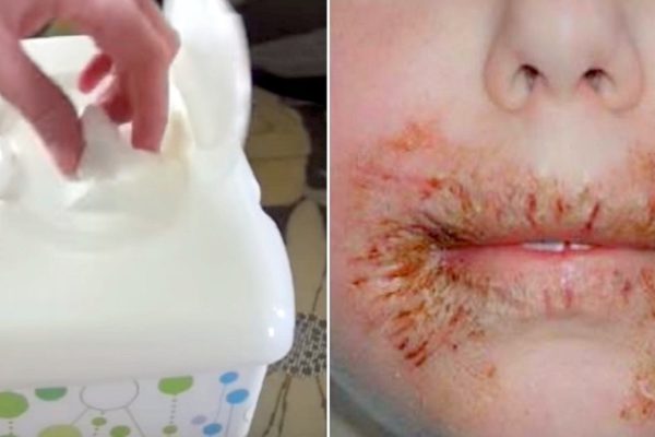 Вот почему я перестала использовать влажные салфетки! Опасность, о которой многие не догадываются…