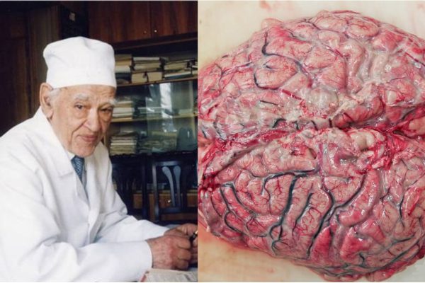 Академик Углов: «Нет такого органа у человека, который бы не страдал от приема спиртных напитков».