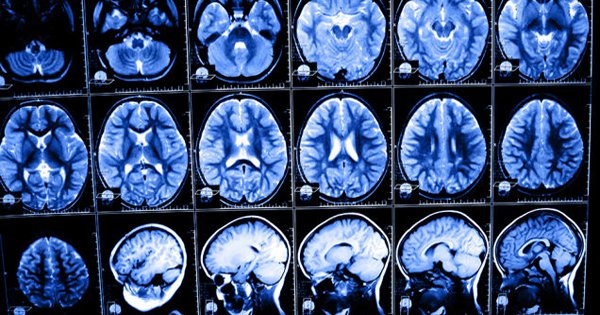 Жуткие последствия цифровой эры: после этого ты запретишь своему ребенку пользоваться гаджетами!