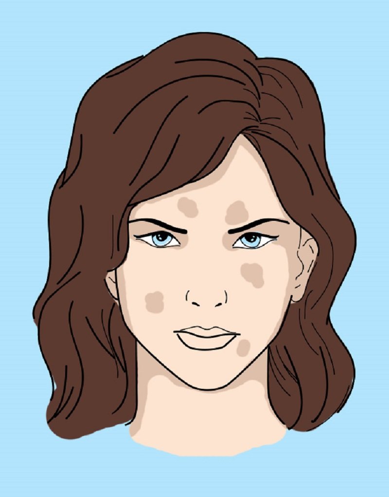 от чего рано стареет кожа