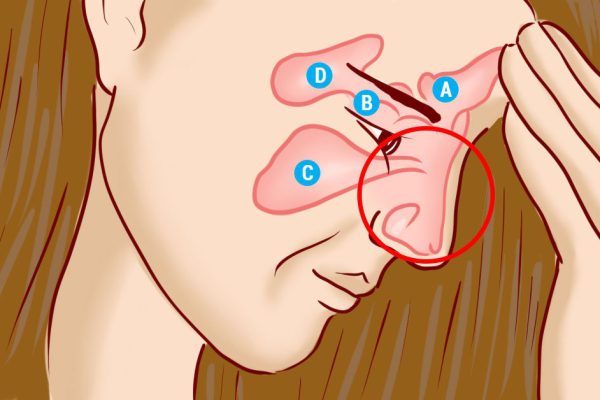Избавься от инфекции носовых пазух всего за 5 минут! Знать бы этот метод раньше…