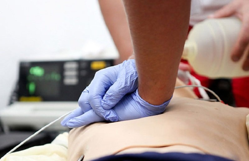 реанимация