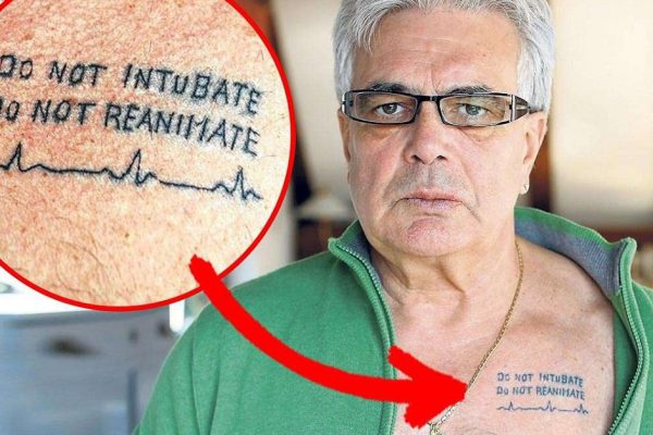 Когда умирает врач, всё по-другому. Вот почему многие отказываются от реанимации…
