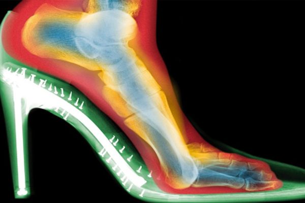 5 вещей, которые происходят с твоим телом, когда ты снимаешь каблуки.