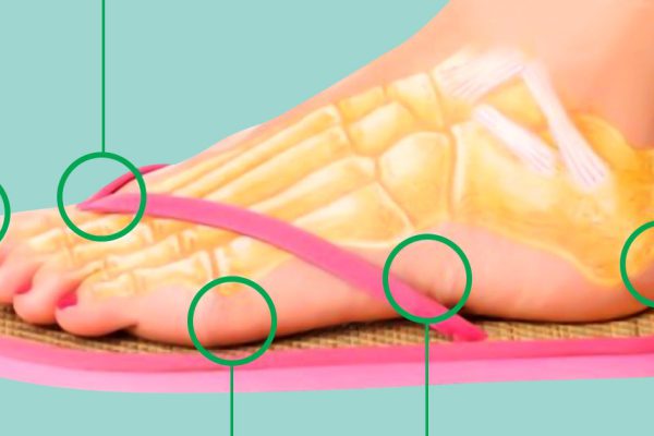 Теперь я ношу вьетнамки не больше 1 часа в день! И вот почему…