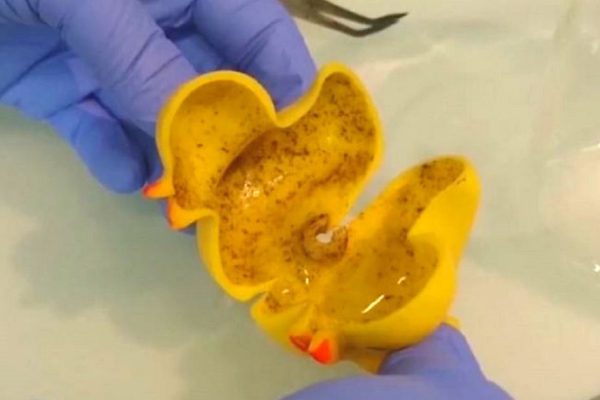 Врачи предостерегают: «Все эти уточки для купания — тихая гавань для вредных бактерий». Это крайне опасно!