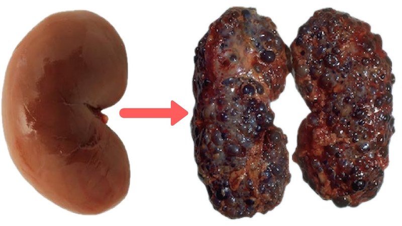 таблетки, опасные для здоровья