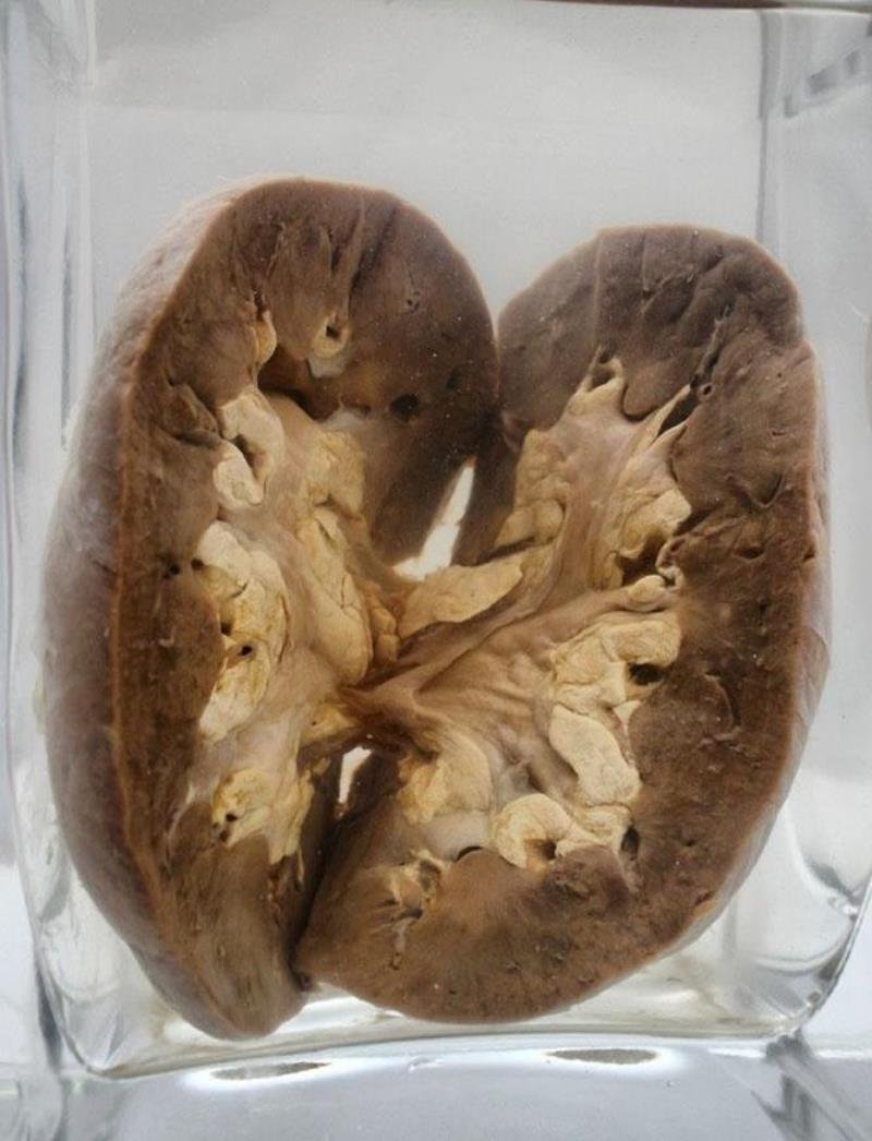 смертельно опасные таблетки