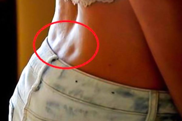 Вот на что указывают эти 2 ямочки на пояснице: особенность, которой стоит гордиться!