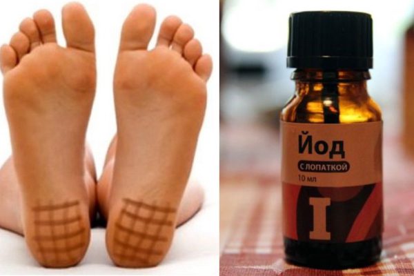 Вот что получится, если нанести немного йода на пятки!