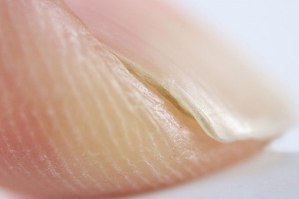 Узнай, какие тайны могут скрывать твои ногти!