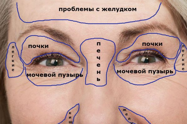 Думала, морщины появились, потому что уже пора! Но оказалось, что причина вовсе не в этом.