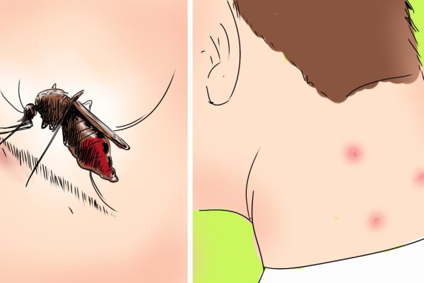 Натуральные средства от вездесущих комаров