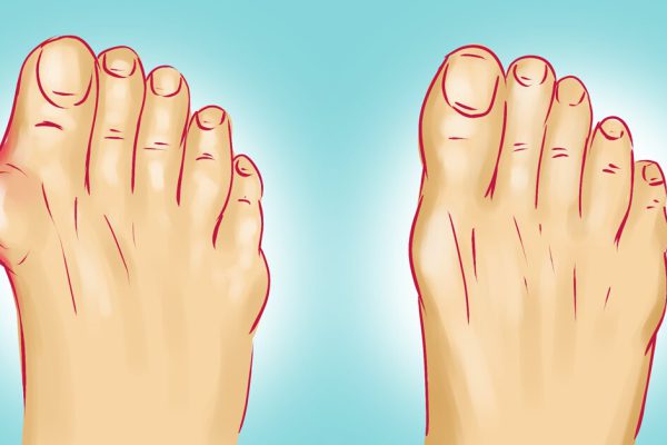 Упражнения для приобретения легкой походки