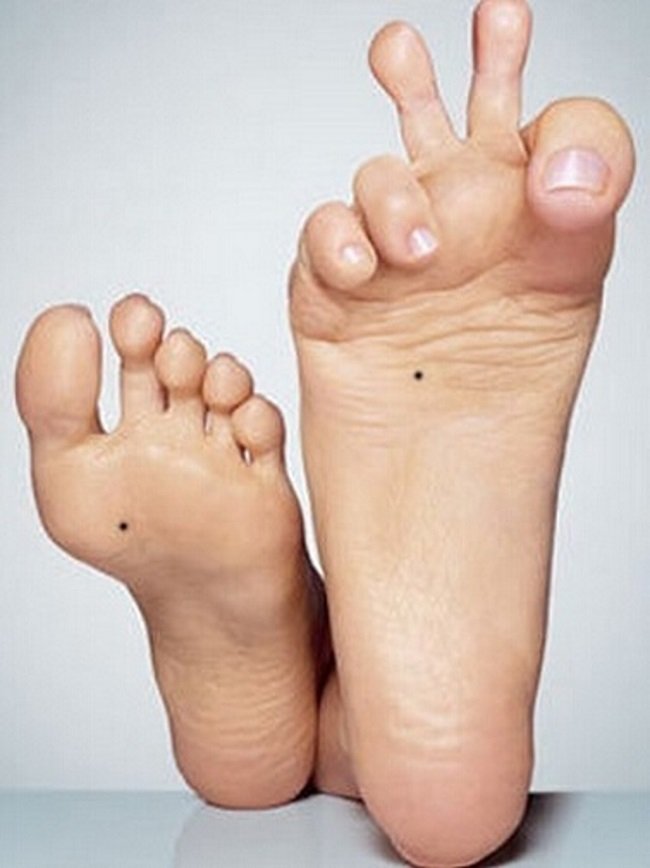 родинка на ступне