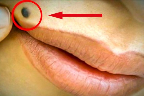 Если у тебя есть хоть одна из этих родинок — тебе можно только позавидовать!