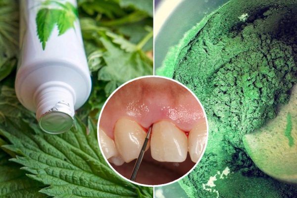 Никакой кровоточивости… Пародонтолог не поверил, а потом и сам попробовал!